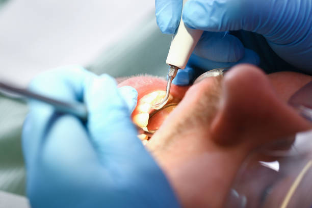 Best Chipped Tooth Repair Near Me  in Walthourville, GA