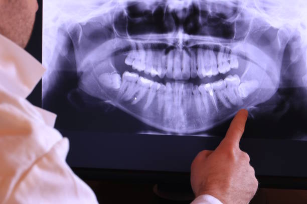 Best Tooth Infection Emergency Dentist  in Walthourville, GA